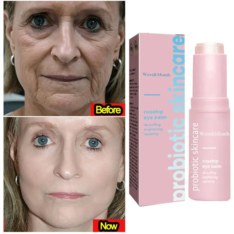 Instant Wrinkle Removal Balm Stick
